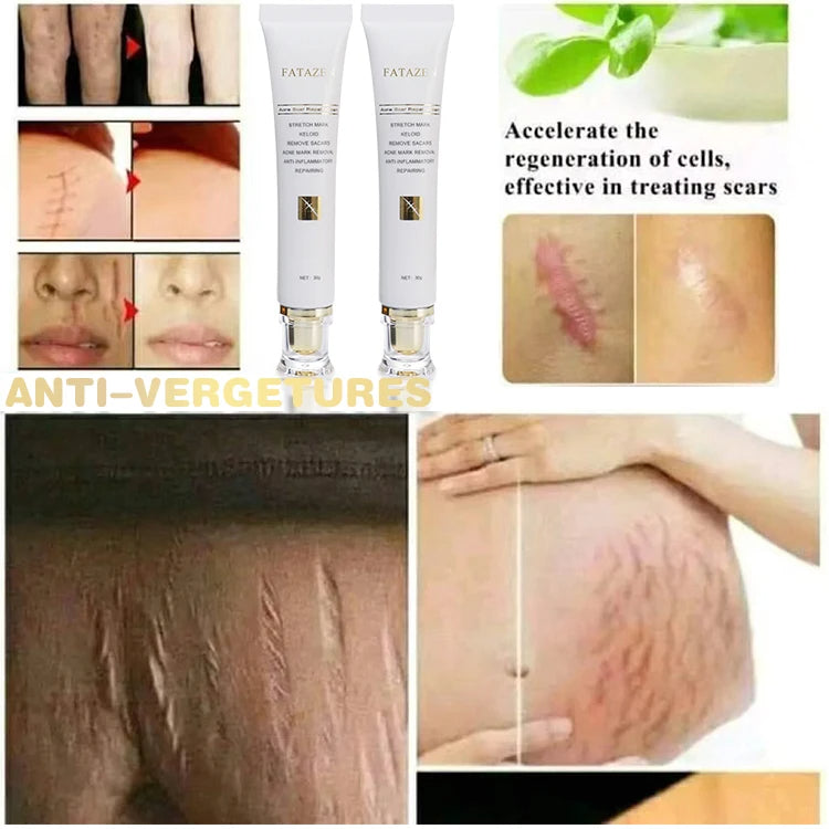 ✨Crème naturelle pour éliminer les cicatrices ✨