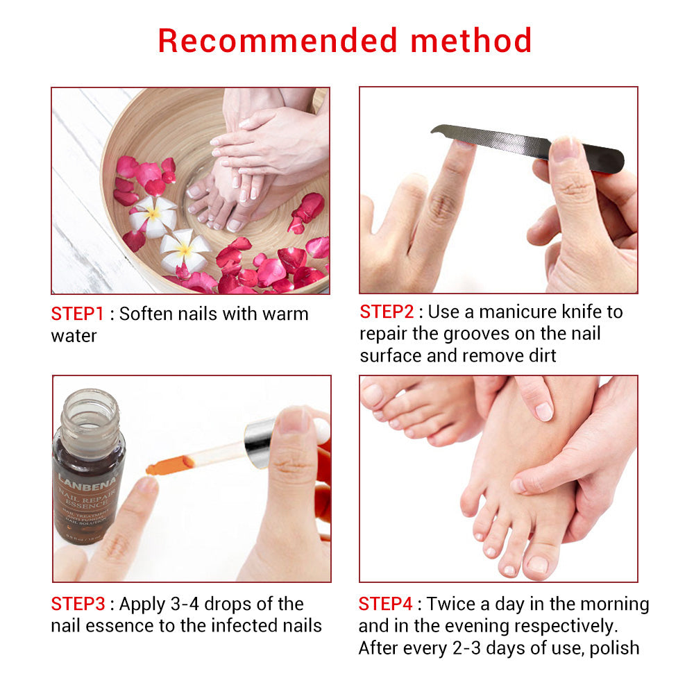 Sérum de réparation des ongles, Gel Anti-Infection