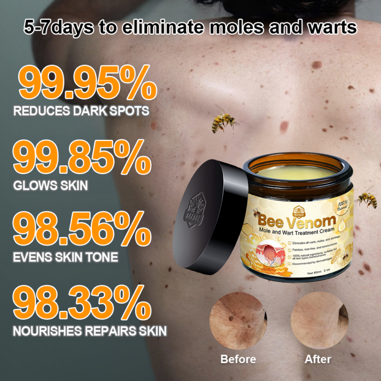 Crème de traitement contre les taupes et les verrues Brezey™ Bee Venom Mole