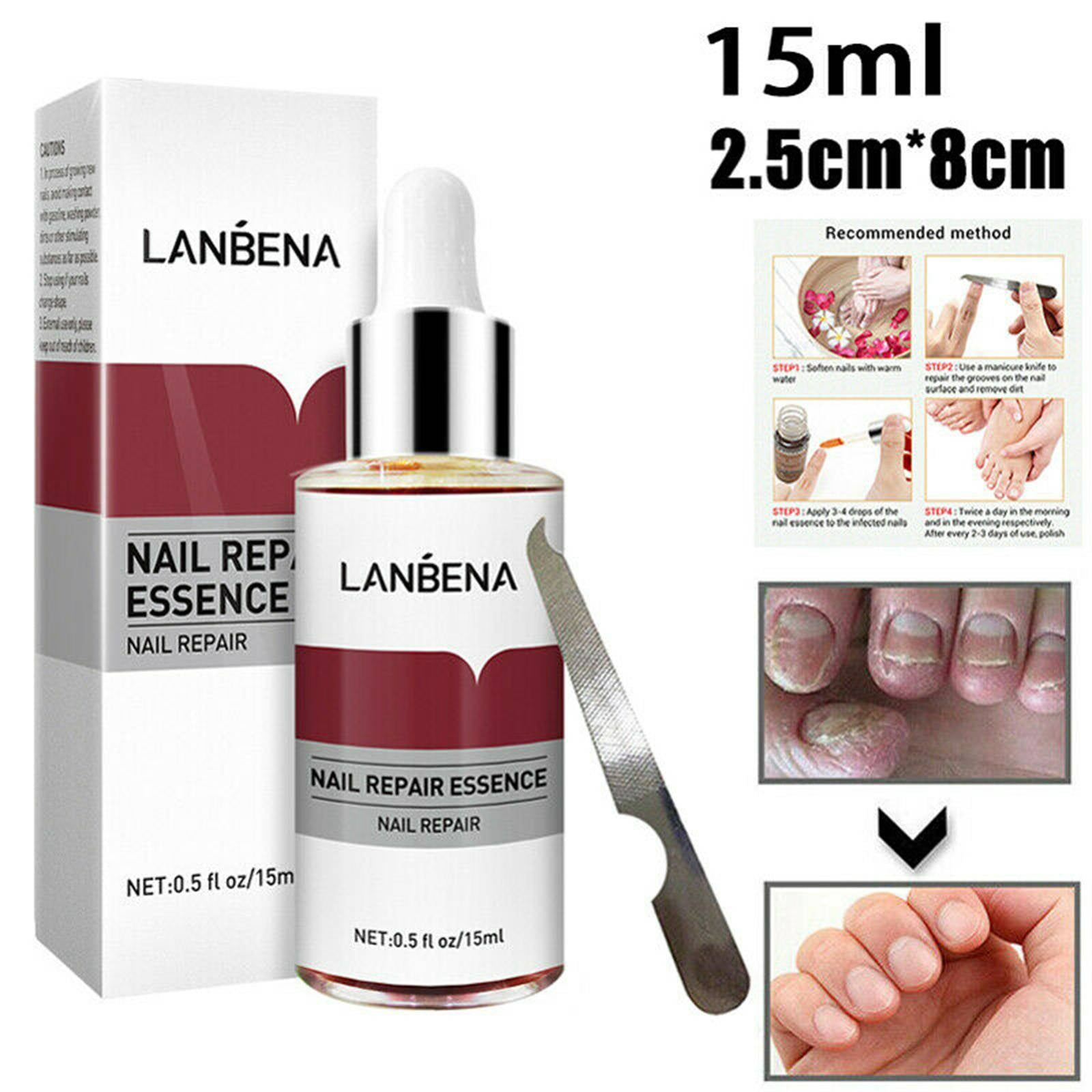 LANBENA-Sérum réparateur pour les ongles