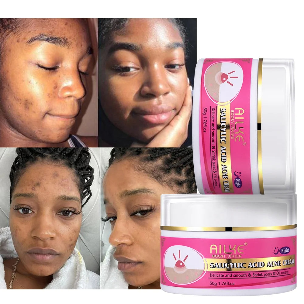 Crème Anti-Acné à l'Acide Salicylique Bio pour un Teint Pur et Rayonnant