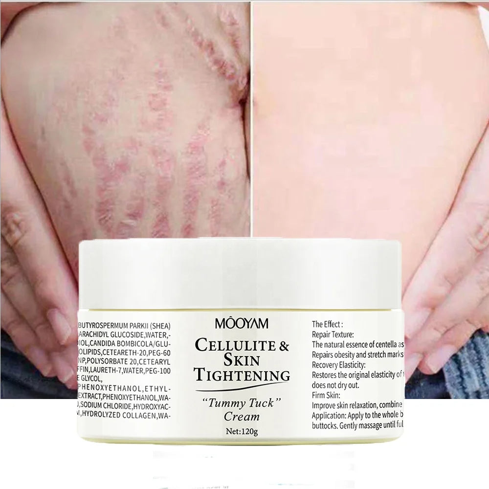 Crème Multifonction Anti-Cellulite, Anti-Vergetures et Protectrice