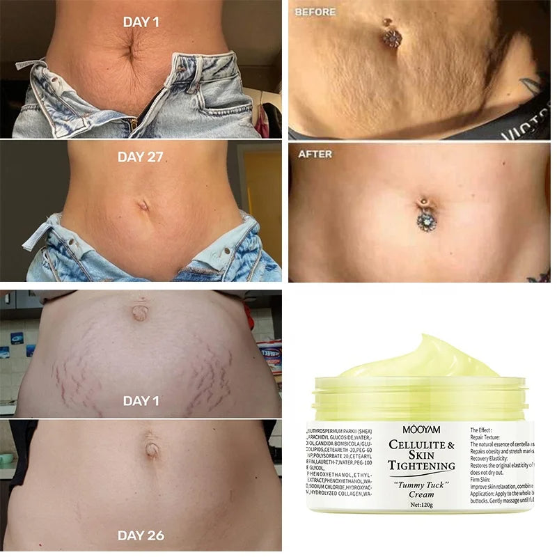 Crème Multifonction Anti-Cellulite, Anti-Vergetures et Protectrice