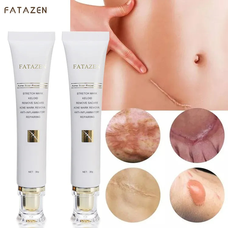 ✨Crème naturelle pour éliminer les cicatrices ✨
