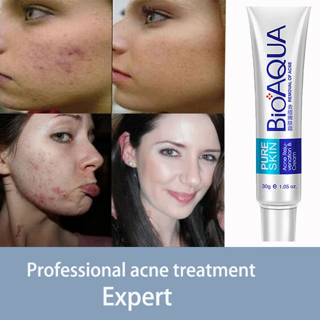 Crème Anti-Acné Bioaqua