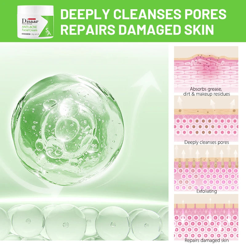 Crème Visage Anti-Acné Disaar