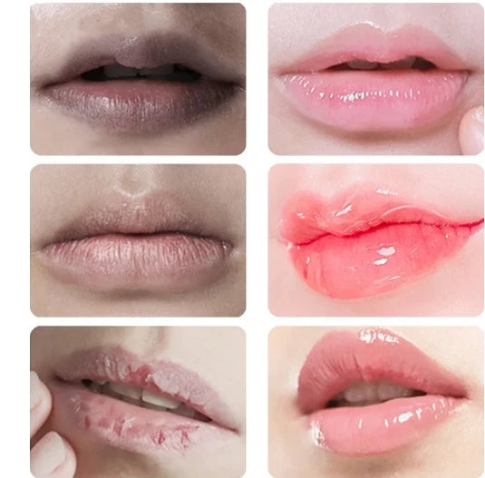 Baume à lèvres Élimine les cernes Hydratant Éclaircissant