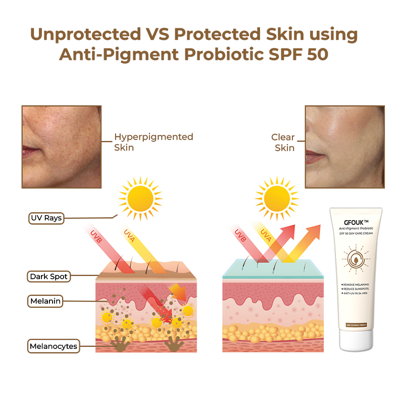 Crème de soin de jour GFOUK Anti-Pigment Probiotic SPF 50