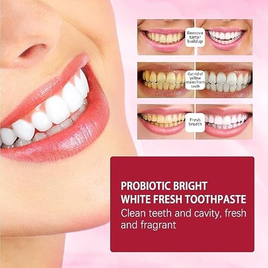 Dentifrice Super Probiotic-4 avec 4 probiotiques équilibre Force du microbiote buccal