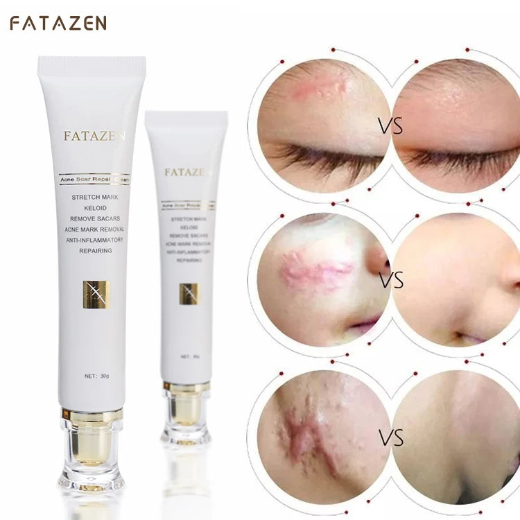 ✨Crème naturelle pour éliminer les cicatrices ✨