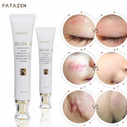 ✨Crème naturelle pour éliminer les cicatrices ✨