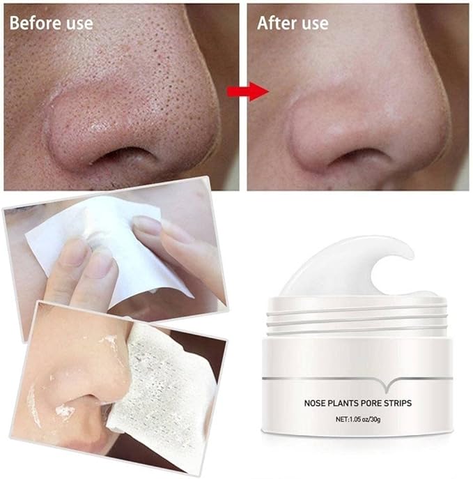 Nelora Bandes d'élimination des points noirs