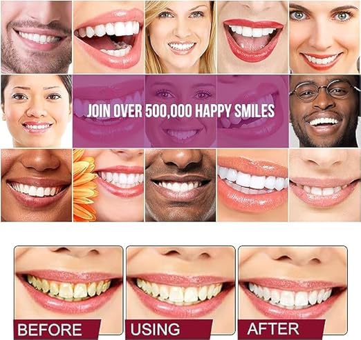 Dentifrice Super Probiotic-4 avec 4 probiotiques équilibre Force du microbiote buccal