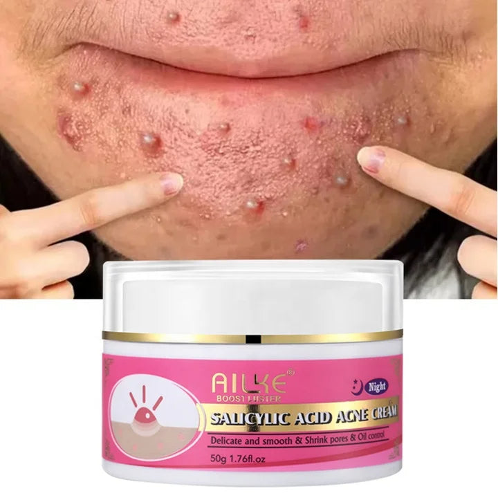 Crème Anti-Acné à l'Acide Salicylique Bio pour un Teint Pur et Rayonnant