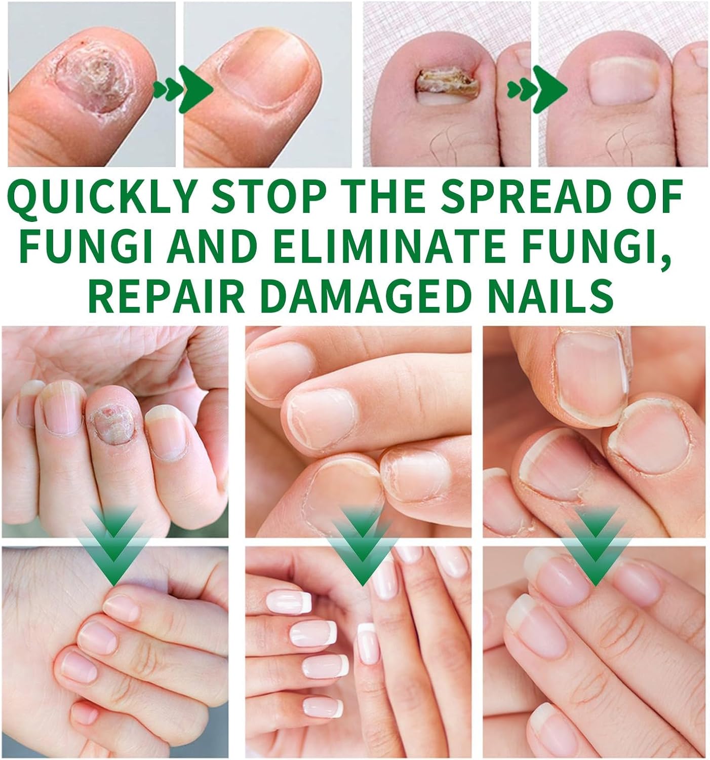 7 Days Fungus ® -(50 ml)