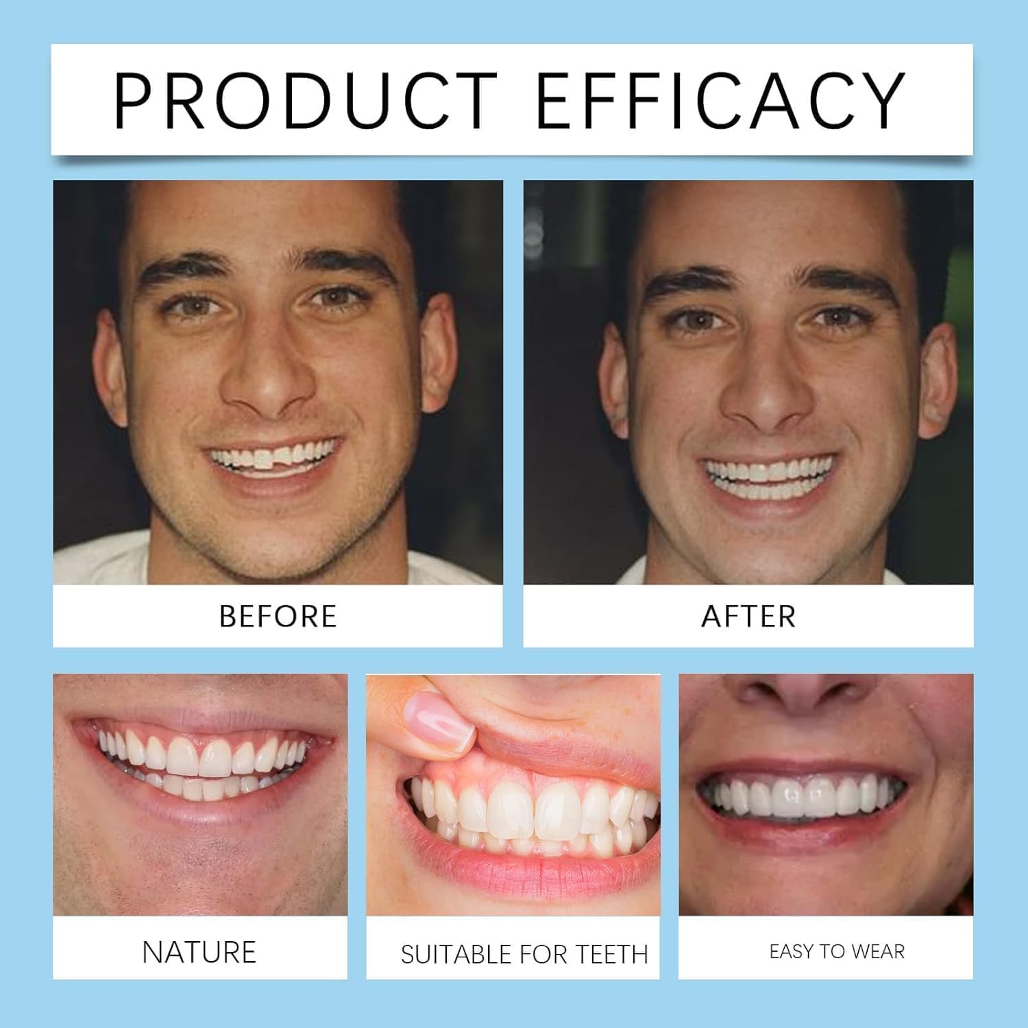 les prothèses dentaires en silicone Forzero