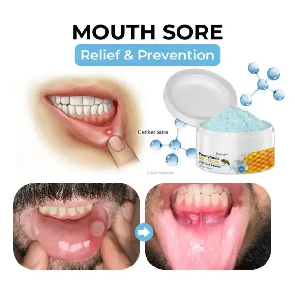 Bikenda™ Poudre orale de traitement au venin d'abeille Focus Smile