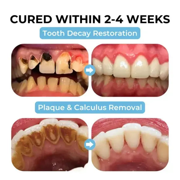 Bikenda™ Poudre orale de traitement au venin d'abeille Focus Smile