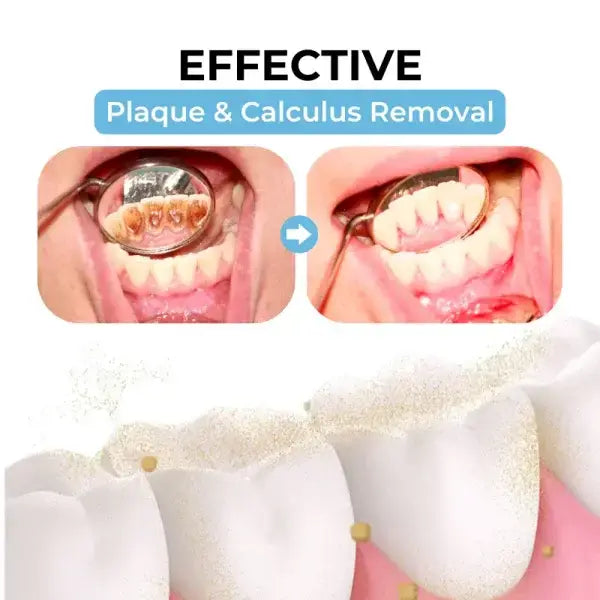 Bikenda™ Poudre orale de traitement au venin d'abeille Focus Smile