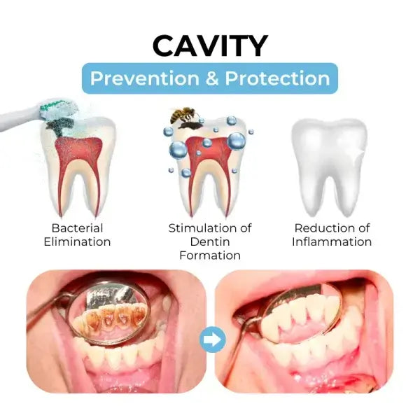 Bikenda™ Poudre orale de traitement au venin d'abeille Focus Smile