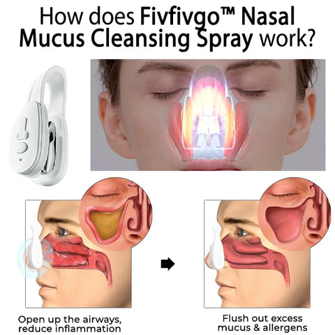 Nose Repair Device