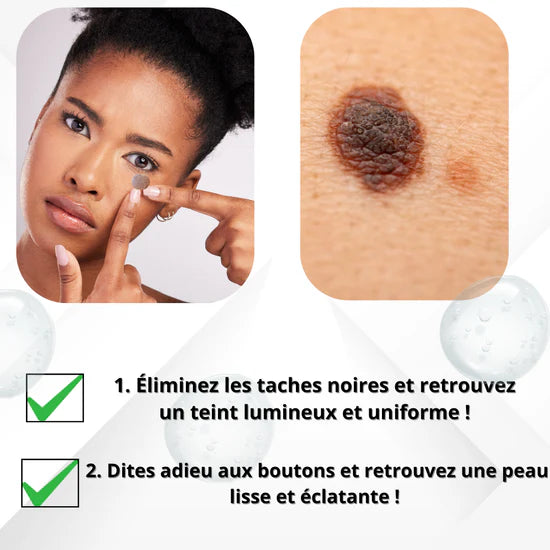 Gel R𝐞́p𝐚r𝐚t𝐫i𝐜e M𝐮l𝐭i𝐟o𝐧c𝐭i𝐨n𝐧e𝐥l𝐞 𝐁i𝐨s𝐤i𝐧