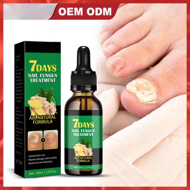 7 Days Fungus ® -(50 ml)