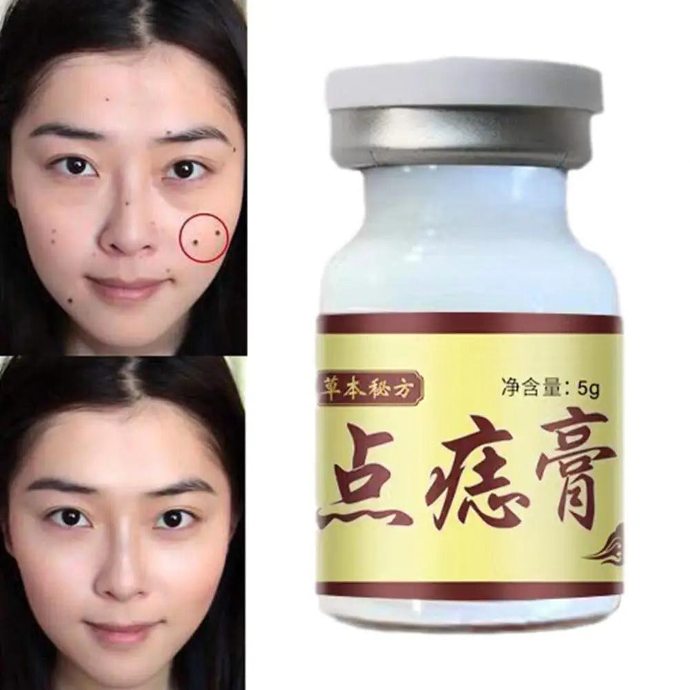 Dissolvant de taches brunes pour le corps, soin de la peau du visage